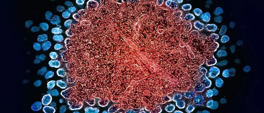 blue red cel